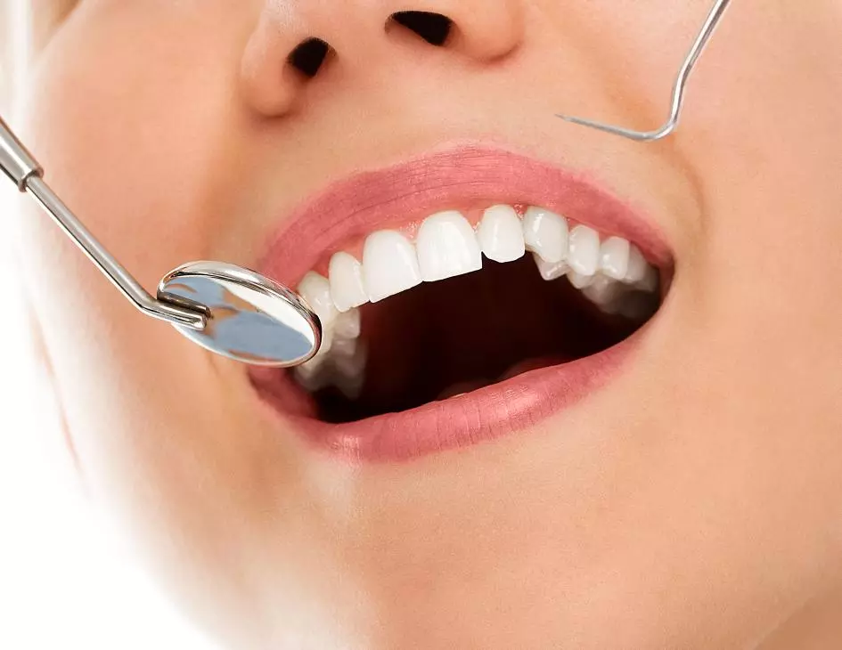 Dental Veneers with Zirconium - Private Eliz Dent Oral and Dental Health Polyclinic