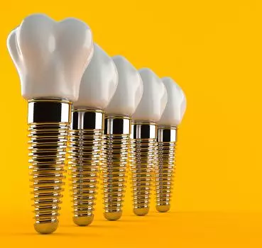 İmplant Tedavisi Nedir? - Özel Eliz Dent Ağız ve Diş Sağlığı Polikliniği