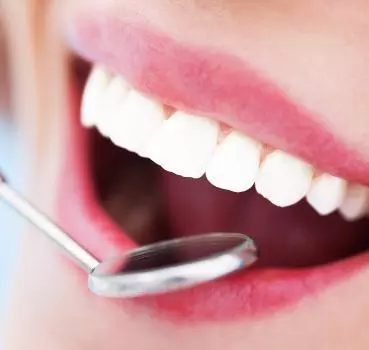 Porcelain Laminates - Private Eliz Dent Oral and Dental Health Polyclinic