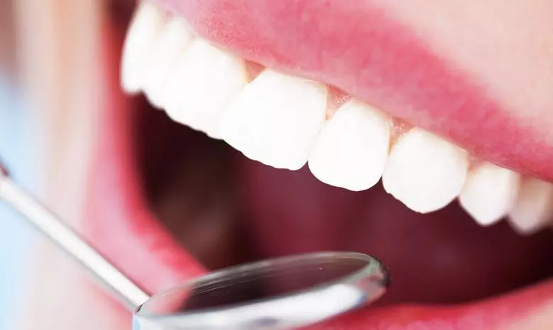 Porcelain Laminates - Private Eliz Dent Oral and Dental Health Polyclinic