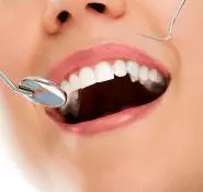 Zirconium - Private Eliz Dent Oral and Dental Health Polyclinic